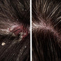 Anti Dandruff Hair Oil | Clear Flakes & Itchy Scalp Naturally - image 5