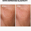 Ultra C++ Vitamin C Serum - For Dead skin and Pigmentation - image 5