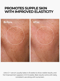 Ultra C++ Vitamin C Serum - image 5