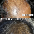 Saynoor OLI - Natural Hair Oil for Men & Women - image 7