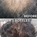 Saynoor OLI - Natural Hair Oil for Men & Women - image 9